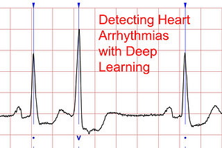 Detecting Heart Arrhythmias with Deep Learning in Keras with Dense, CNN, and LSTM
