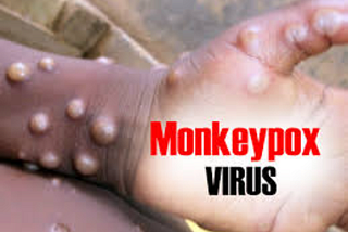 Understanding Mpox: What You Need to Know