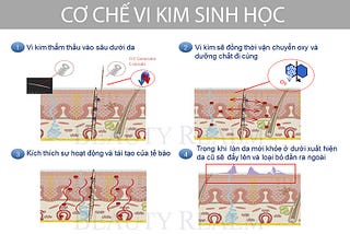 Cơ chế vi kim sinh học