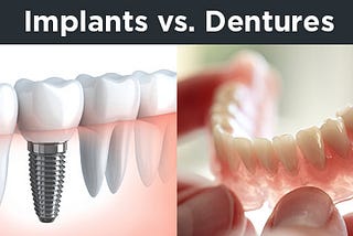 Dentures vs Implants: Pros and Cons