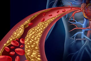 Detecting Cardiovascular Diseases Using Machine Learning