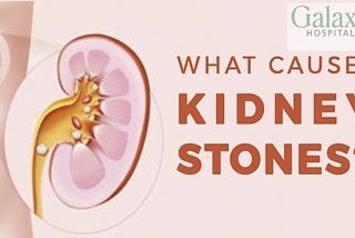 The Best Kidney Stone Specialist Hospital in Varanasi