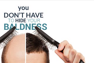 Hair Transplant: Revive Your Hair And Offer It A New Look