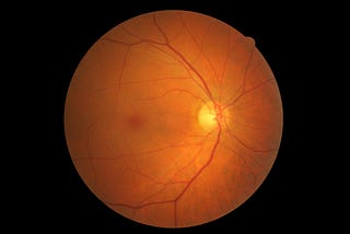 Detecting eye disease using AI (kaggle bronze place)