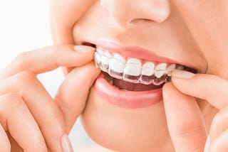 Achieve Your Perfect Smile with Invisalign Treatment Near Bakersfield