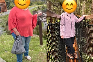 I’m Not Fat Anymore, Thanks to Bariatric Surgery