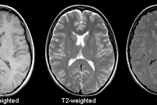 Analyzing MRI Images Based on Their Sequences (T1 and T2 Weighted Images) concerning their pulse…