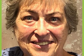 I’m Aware That I’m Rare: Sue Liss (487)
