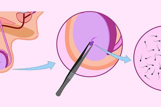 Azoospermia: Everything You Need To Know About The Cause, Effect, and Treatment