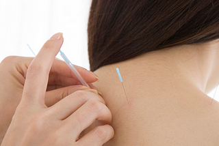 Transforming Neck and Shoulder Pain Relief: The Acupuncture Advantage