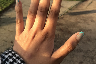 A hand with painted nails and the nail paint chipping off.