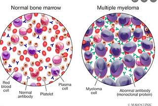 Myeloma Chronicles.. The Disease