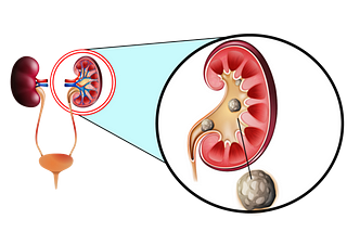 About Marc Uro 5 Medicine