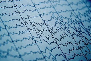 An Overview Of Outlier Detection Algorithms In EEG Data With Code Examples