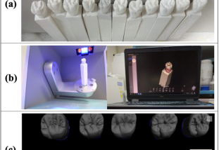 Applying Artificial intelligence to assess the morphology of sculpted teeth