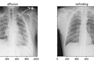 x-ray classes comparison