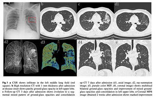 Case Study: COVID-19