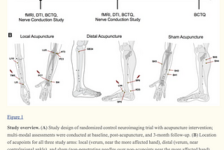 From “Rewiring the Primary Somatosensory Cortex in Carpal Tunnel Syndrome with Acupuncture”