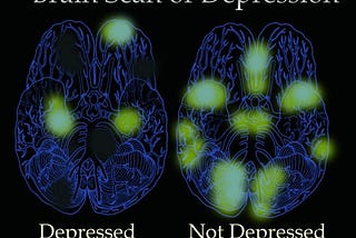 Path-of-what-is(iology) Depression