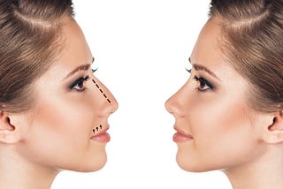 rhinoplasty procedures