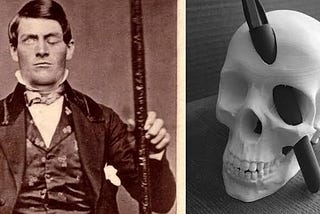 Phineas Gage with an Image of his impaled skull.