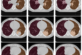 Lungseg: open-source lung segmentation on CT scans