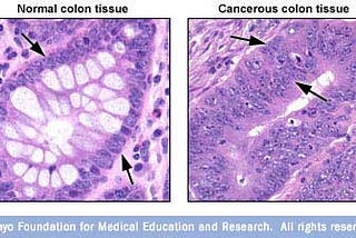 CURE FOR CANCER.