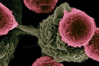 Pancreatic Cancer Is Often Diagnosed Late. The Clues to Catch It Earlier May Already Exist