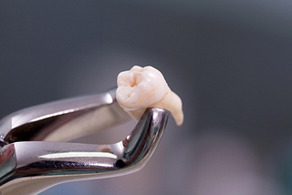 Say Goodbye to Tooth Pain: Insights on Tooth Extractions