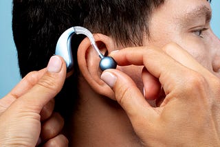 Cochlear Implants: A Complete Guide