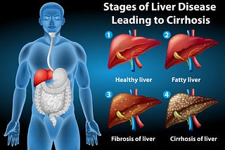 What is Non Alcoholic Fatty Liver Disease?