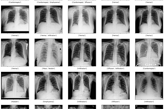 🧠 How I Accidentally Became a Medical AI Wizard (CheXNet, Kaggle GPUs & Pure Fear)