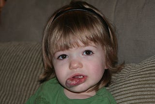 Young child with large vascular birthmark on the lip and chin.