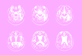 fMRI images of the brain