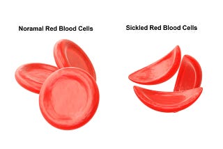 Unraveling Sickle Cell Disease: An In-Depth Examination