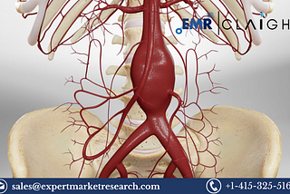 North America Aortic Stent Graft Market Size, Share, Report and Forecast 2024–2032