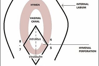 Hymenoplasty Article in Aesthetic Surgery Journal