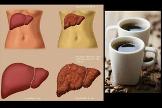 Drink Coffee to Save the Liver from Alcohol Damage