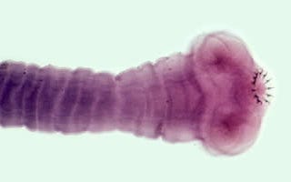 Image of the parasitic flatworm Taenia solium.
