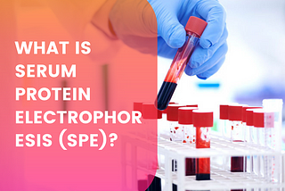 What is Serum Protein Electrophoresis (SPE)?