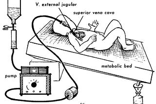 Jonathan Shaw and the Epicutaneo-Cava catheter
