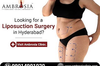 Liposuction Surgery