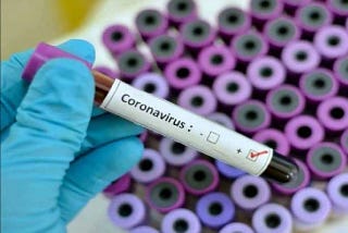 Is a Headache a Symptom of Coronavirus? Here’s What Experts Say