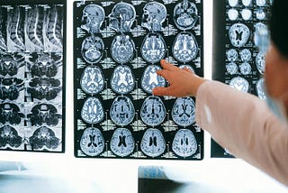Head CT Foundation Model Outperforms Commercial Alternatives, Detects Diseases Beyond Hemorrhage