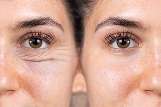 Are You Making These Mistakes? Causes of Eye Wrinkles Revealed!