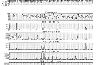 Brief Review — Development of the polysomnographic database on CD-ROM