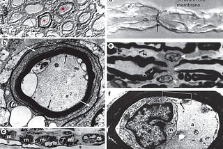 Top 10 Neurology Papers in January