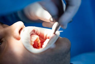 How Gum Surgery Can Improve Your Appearance