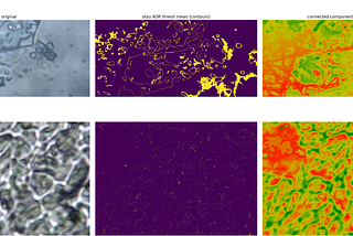 microspy photography of a fungal network (mycelium) and its processed versions