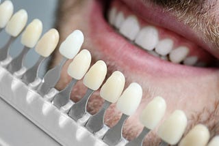 How To Choose The Right Veneers For You?
